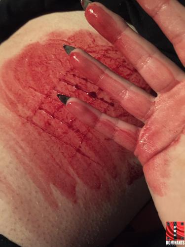 I love getting blood all over my hands!