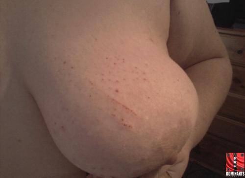 Some slight vampire glove marks.
