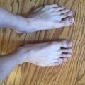 mhfeet