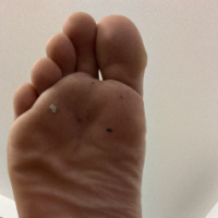 FEET RULES