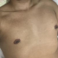 Rick Dale