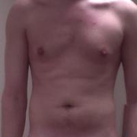 Homo