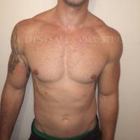 calidoms