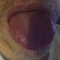Bostonfaggot