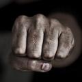 BruisedFaggot31