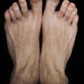 FeetFaggot