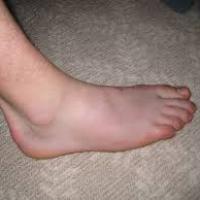 uggofatass