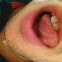 Cocksucker