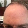 StLBrian