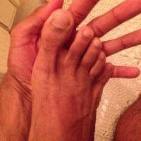 Herzog