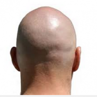 lostknoch